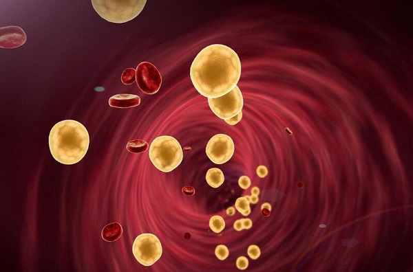 Giải mã mối nguy từ mỡ máu – rối loạn lipid máu