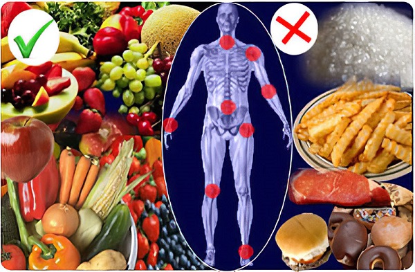 Vai trò của thực phẩm với sức khỏe viêm khớp