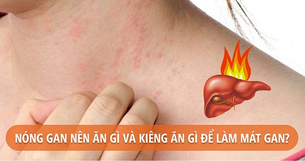 Lời khuyên trị mụn do nóng gan