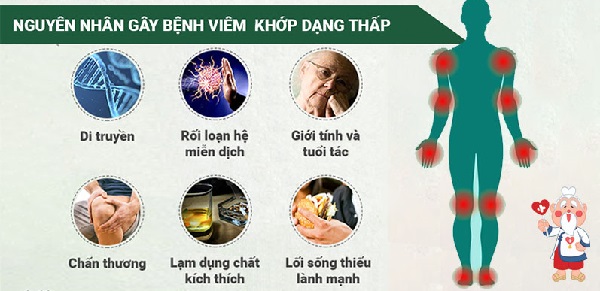 Hình ảnh minh họa viêm khớp nhiễm khuẩn - Bệnh lý ảnh hưởng vận động