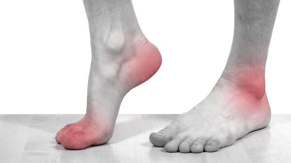 Viêm khớp gây ảnh hưởng nghiêm trọng đến chất lượng cuộc sống