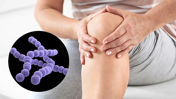 Môi trường và thói quen vệ sinh ảnh hưởng lớn tới sức khỏe khớp