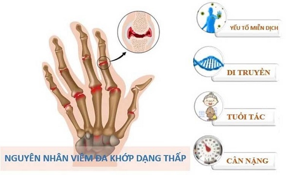 Giải pháp tăng cường sức khỏe xương khớp với thảo dược thiên nhiên