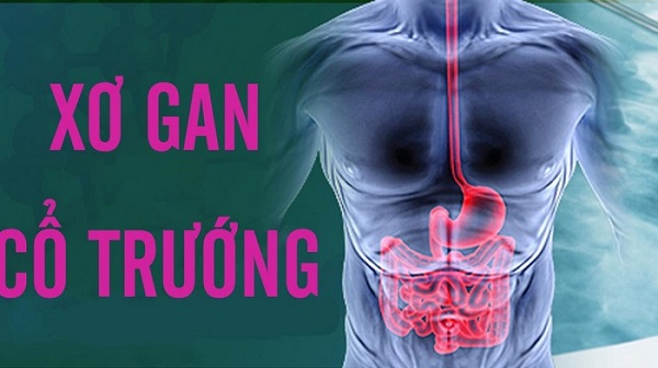 Sản phẩm thảo dược tự nhiên hỗ trợ gan của THAPHACO
