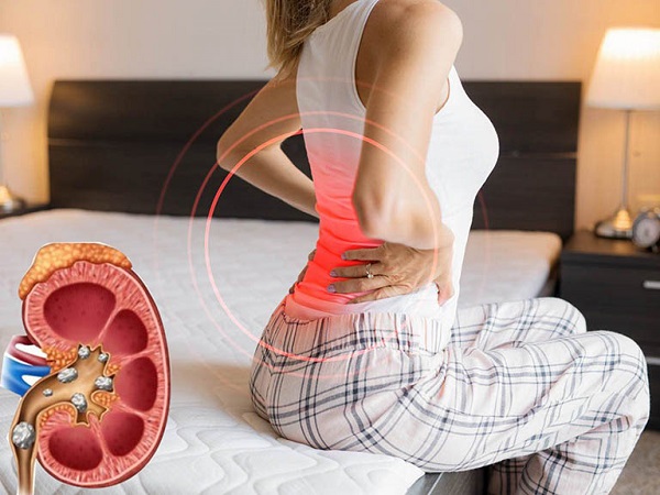 So sánh nước ngọt và nước thảo dược