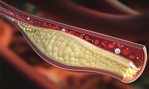Chế biến sinh tố đúng cách hỗ trợ kiểm soát mỡ máu