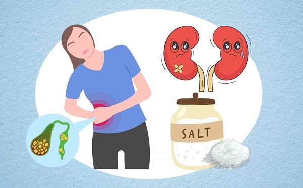 hình ảnh thực phẩm cần hạn chế với người sỏi thận