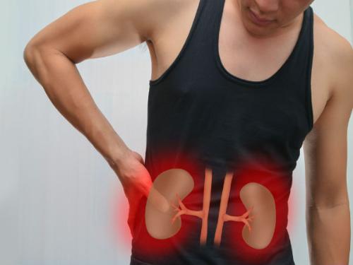 phòng ngừa sỏi thận chủ động