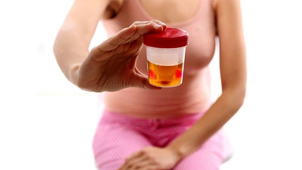Lời khuyên trước hiện tượng tiểu ra máu nghi sỏi thận