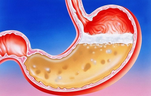 Thảo dược hỗ trợ điều trị loét dạ dày: lợi ích và rủi ro