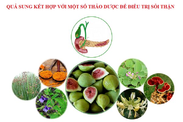 Thảo dược điều trị sỏi thận