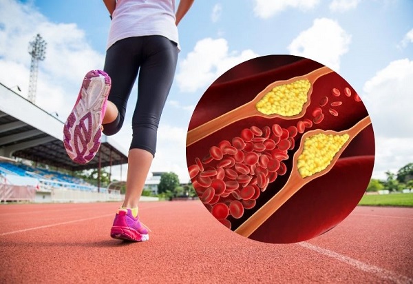 Thể dục là yếu tố quan trọng giúp giảm mỡ trong máu, phòng ngừa bệnh tim mạch.