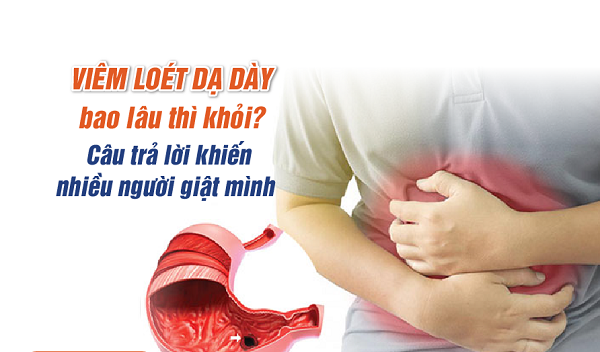 Thảo dược hỗ trợ điều trị viêm loét dạ dày