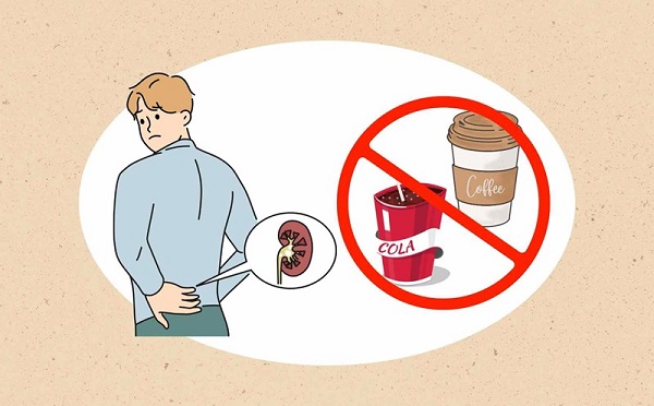 Nguy cơ sức khỏe nghiêm trọng nếu không phòng ngừa sỏi thận