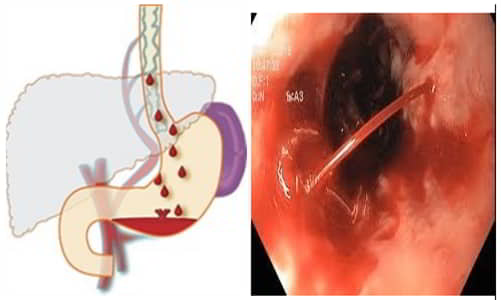 Giải pháp chủ động cho sức khỏe tiêu hóa