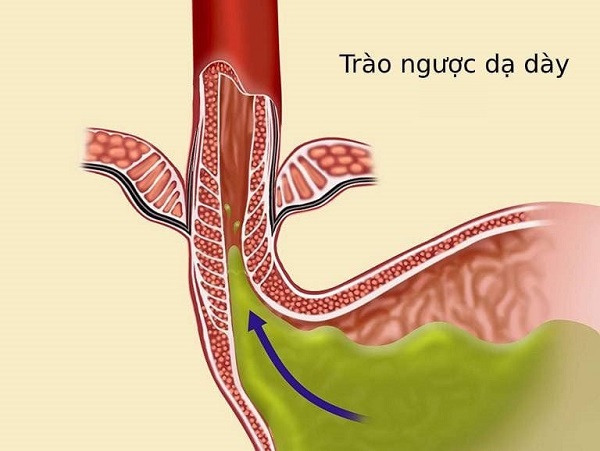 Nghiên cứu về thảo dược và tiêu hóa