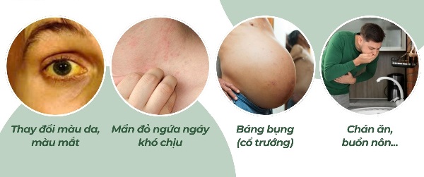 Minh họa nguyên nhân nóng gan