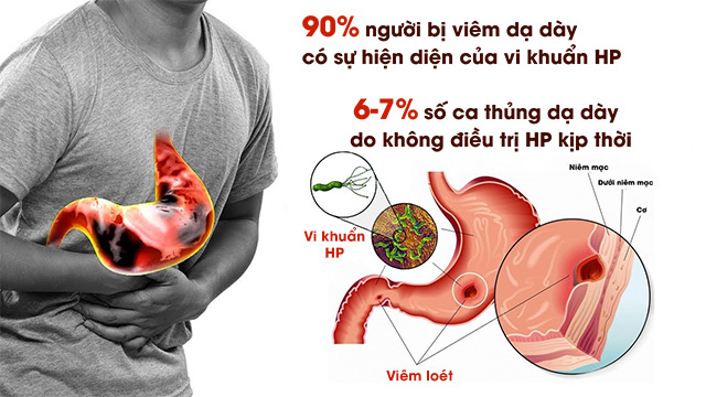 Cảnh báo các rủi ro khi tự ý dùng thảo dược trị dạ dày
