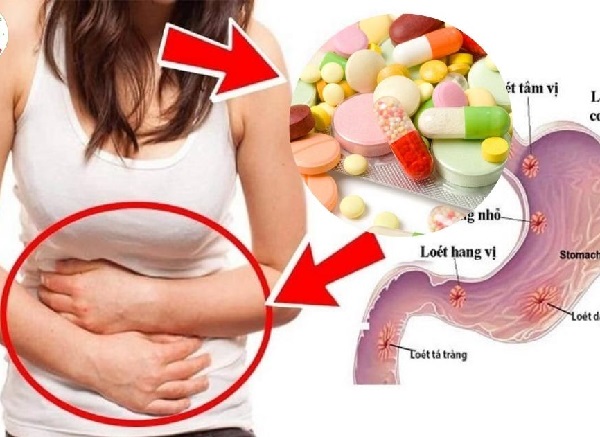 5 nguyên tắc trị dạ dày lành mạnh