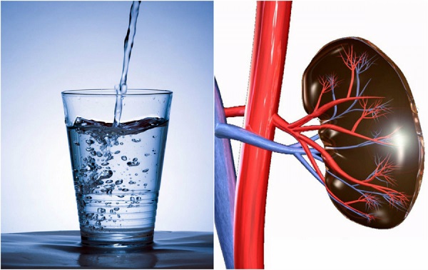 Sự tương tác giữa nước và quá trình hình thành sỏi thận