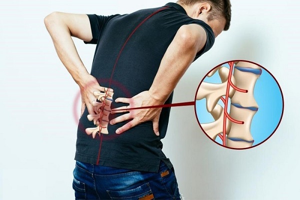 Cấu trúc cột sống bị viêm dính khớp