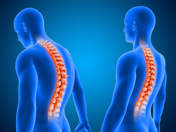 Quá trình tiến triển của viêm cột sống dính khớp