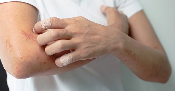 Cùng triệu chứng có thể do nhiều nguyên nhân