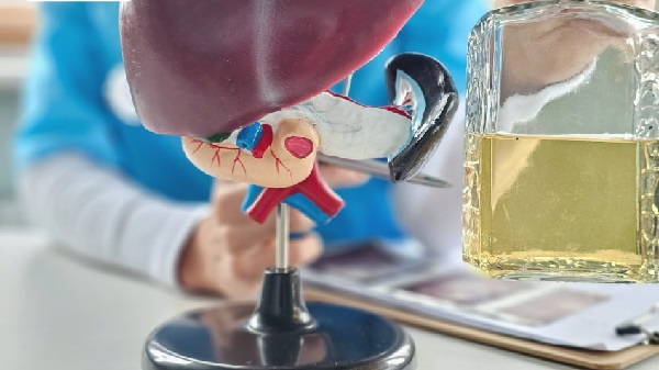 Nguy cơ biến chứng khi không kiêng rượu bia với người viêm gan