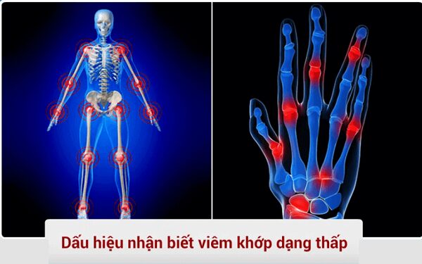 Hình ảnh cảnh báo nguy cơ nếu sử dụng dược liệu tràn lan hoặc tự ý điều trị