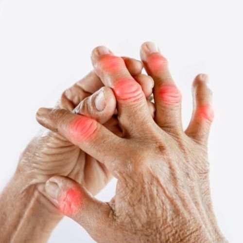 Ảnh minh họa cuộc sống khỏe mạnh bên thảo dược