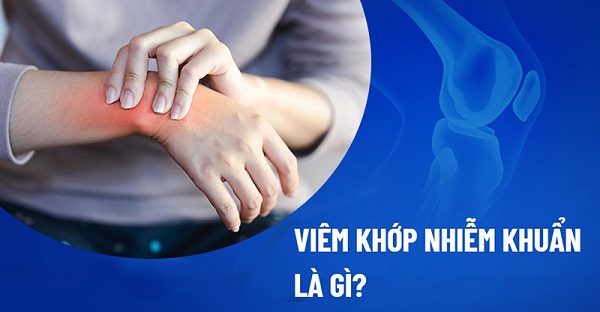 Thảo dược hỗ trợ điều trị viêm khớp từ Tấn Phát - Thaphaco