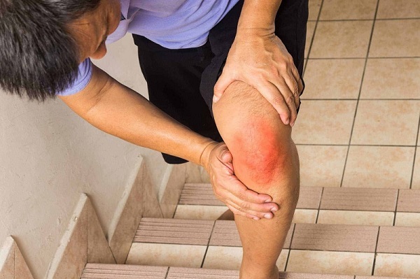 Sản phẩm thảo dược hỗ trợ điều trị viêm khớp từ Tấn Phát