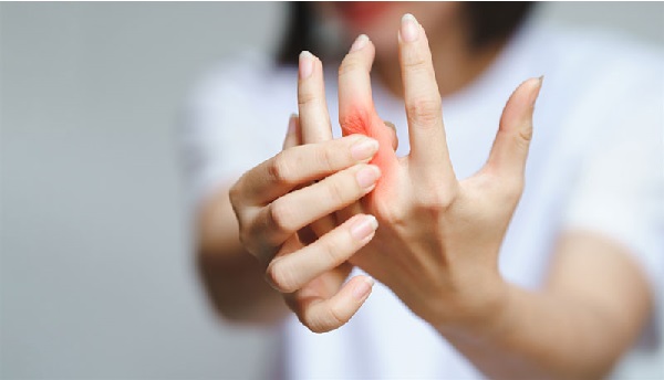 Hormone nữ và miễn dịch tác động đến viêm khớp