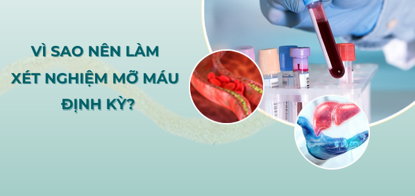 hình ảnh xét nghiệm mỡ máu định kỳ giúp phát hiện sớm bệnh