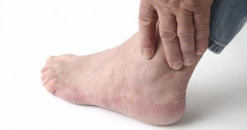 Chế độ ăn nghèo nàn dinh dưỡng tăng nguy cơ bệnh beriberi