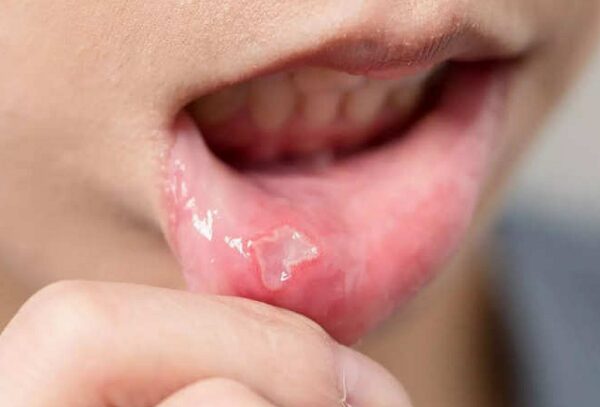 Vai trò của vitamin B đối với chuyển hóa và hệ thần kinh