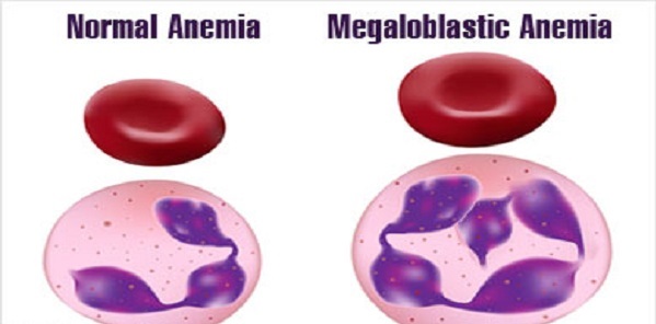 Một bữa ăn cân bằng dinh dưỡng góp phần giữ sức khỏe máu ổn định