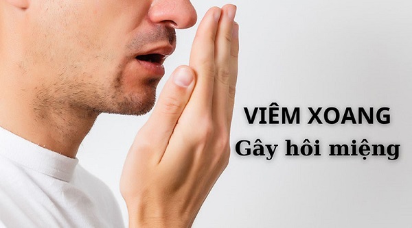 Viêm xoang có thể gây hôi miệng thực sự