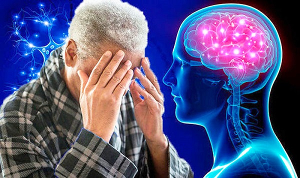 Bệnh Alzheimer ảnh hưởng nghiêm trọng đến trí nhớ và trí não người cao tuổi