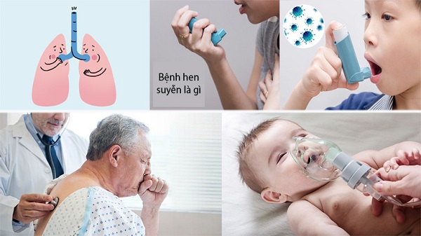 Hình ảnh minh họa nguyên nhân gây hen suyễn và viêm phổi