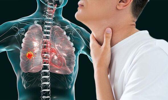 Biến chứng nguy hiểm của ung thư phổi