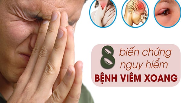 Cảnh báo các biến chứng nguy hiểm của viêm xoang