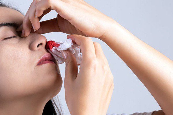 Nguyên nhân chảy máu cam liên quan đến vấn đề tai mũi họng