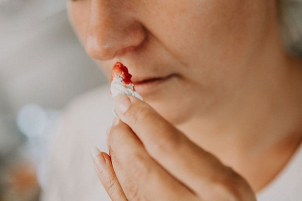Chảy máu cam và các nguyên nhân thường gặp