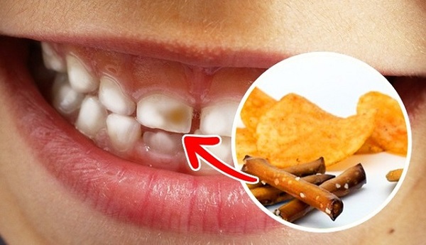 Ảnh minh họa chế độ ăn và sức khỏe răng miệng