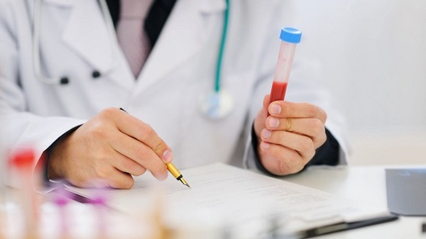 Các yếu tố ảnh hưởng chi phí xét nghiệm tiểu đường