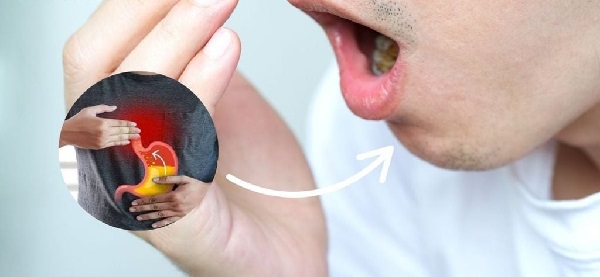 Ảnh minh họa liên quan đến đau dạ dày và hôi miệng