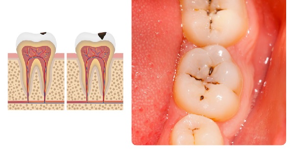 Các dấu hiệu nhận biết bệnh răng miệng