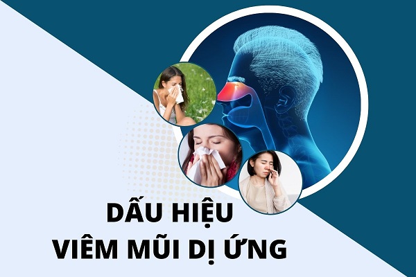 Phấn hoa là tác nhân phổ biến gây viêm mũi dị ứng