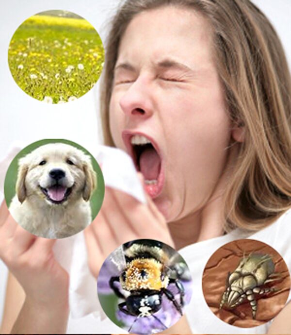 Viêm mũi dị ứng có thể ảnh hưởng cả tai và họng